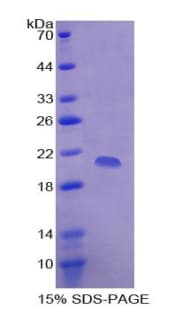Rat p16INK4a / CDKN2A Protein (Recombinant His-T7)