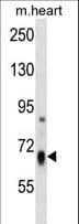 HBS1L Antibody (aa460-486)