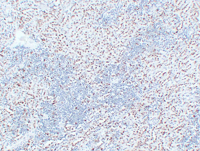 WT1 / Wilms Tumor 1 Antibody (clone ABT-WT1)
