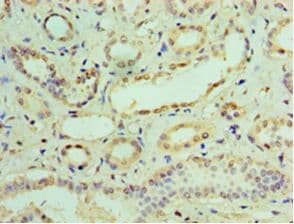 IHC-plus™ IFIT3 Antibody (aa1-490)