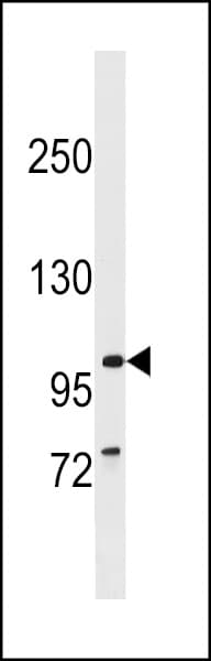 Polyclonal Rabbit anti-Human BBS9 Antibody (aa832-859, WB)