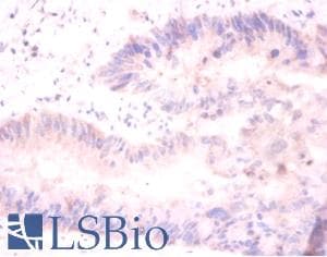 H2AFJ Antibody