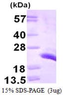 Human CETN1 Protein (Recombinant His)