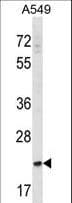 SLAMF9 Antibody (aa242-270)