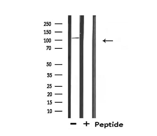 Polyclonal Rabbit anti-Human MED24 / TRAP100 Antibody (IF, WB)