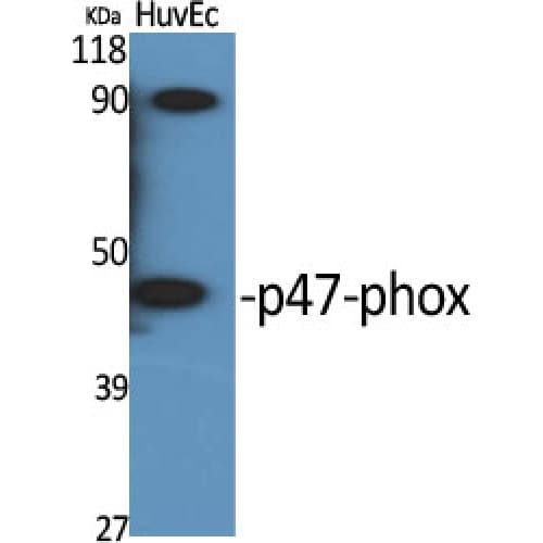 NCF1 / p47phox / p47 phox Antibody (310-390 aa)