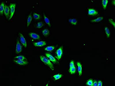 NMUR1 Antibody