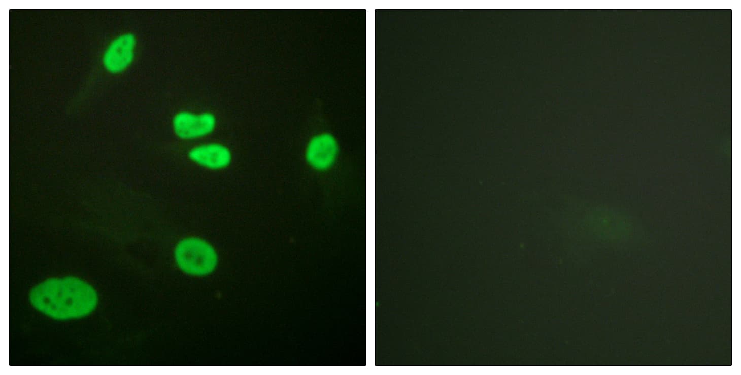 Histone H3 Antibody (Acetyl-Lys9)