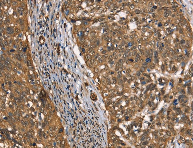 CSTB / Cystatin B / Stefin B Antibody
