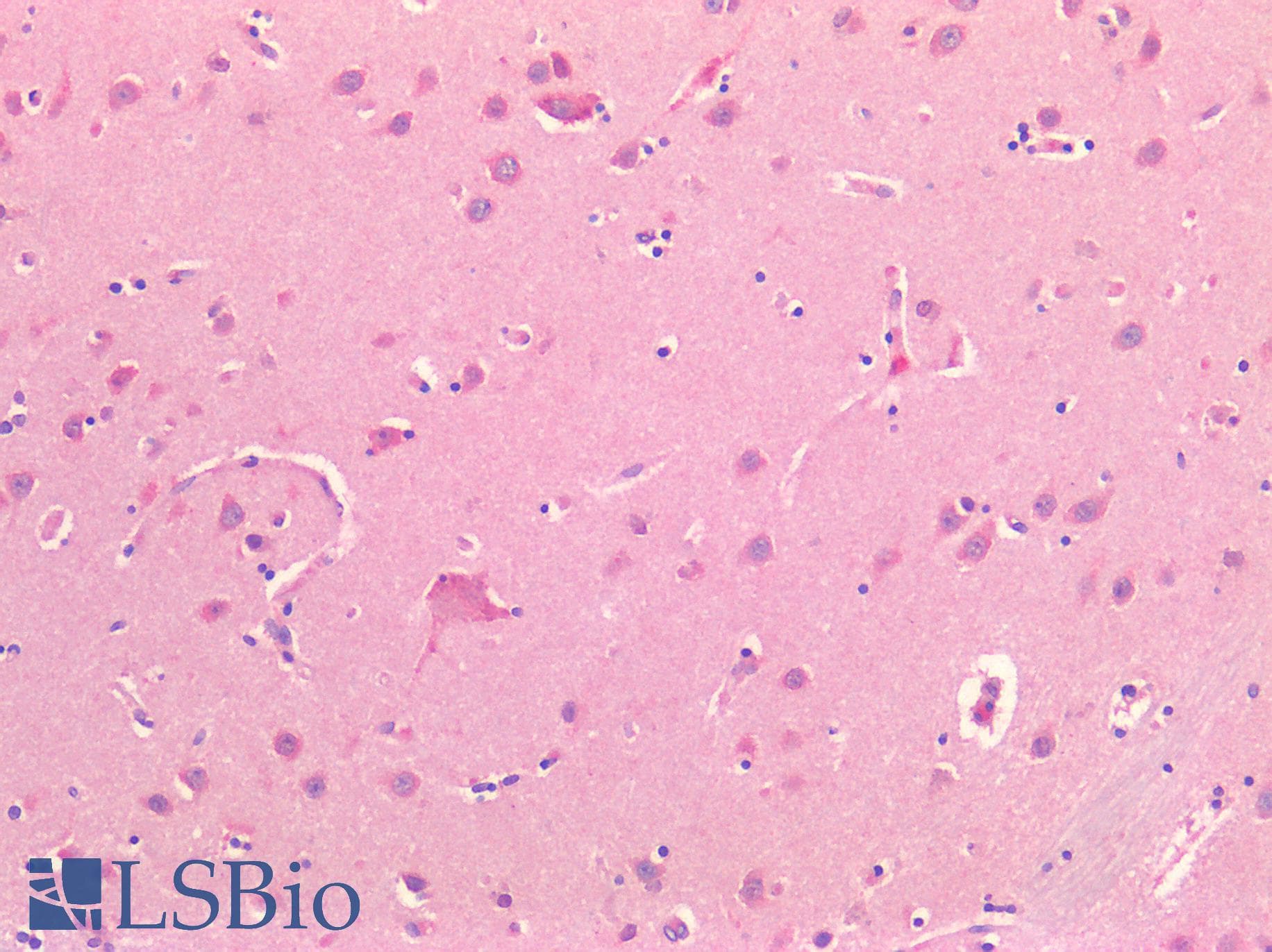 IHC-plus™ ADORA2A/Adenosine A2A Receptor Antibody