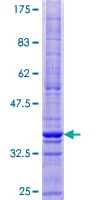 Human CMTM1 Protein (Recombinant GST)