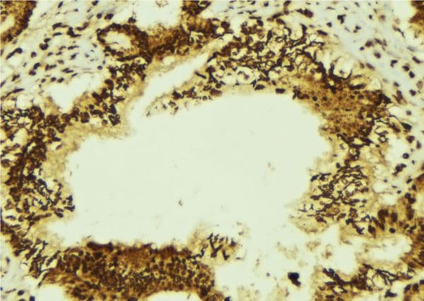 TRA2A Antibody