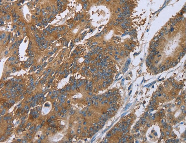 LASS4 Antibody