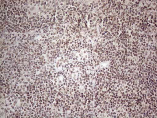 NR2C2 / TAK1 Antibody (aa1-241, clone OTI4B1)