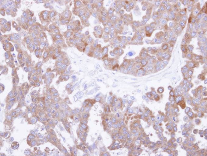 Polyclonal Rabbit anti-Human CCT8 Antibody (aa111-367, IHC, WB)