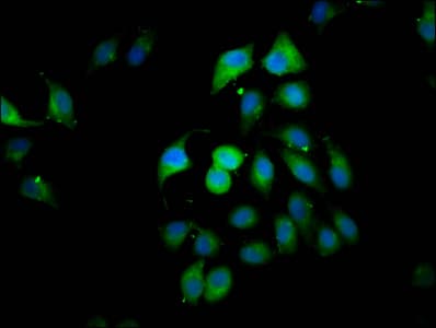 CLIP2 / CYLN2 Antibody