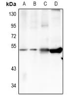 Polyclonal Rabbit anti-Human TRIM59 Antibody (IHC, IF, WB)