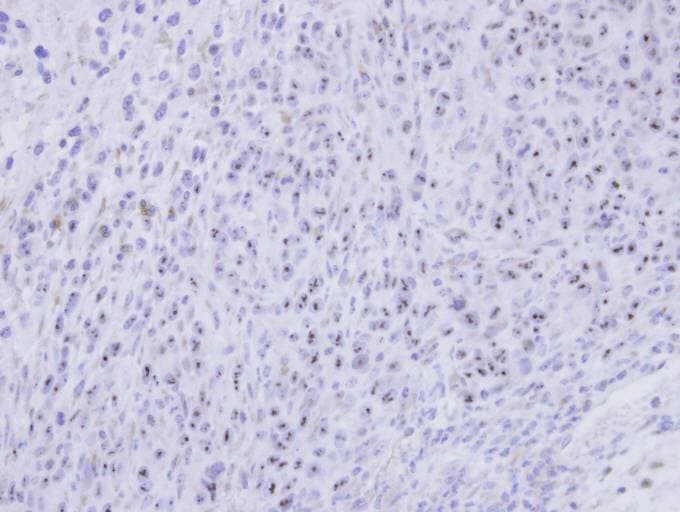 SMC1B Antibody (aa154-433)