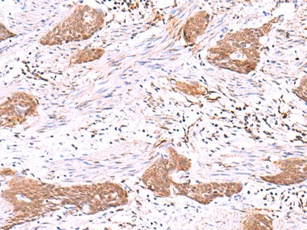 SASH1 Antibody