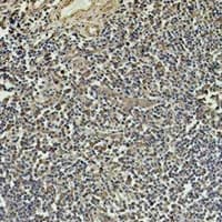 Monoclonal Mouse anti-Human TUBB1 / Tubulin Beta 1 Antibody (IHC, WB)