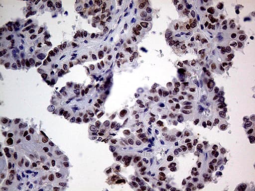 TCF12 / HEB Antibody (clone OTI3C11)