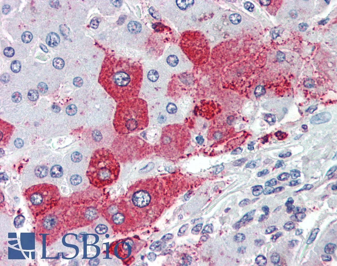 IHC-plus™ Polyclonal Rabbit anti-Human KIAA1324 / maba1 Antibody (Internal)