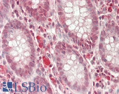 IHC-plus™ ABCG1 Antibody (560-640 aa, C-terminal)