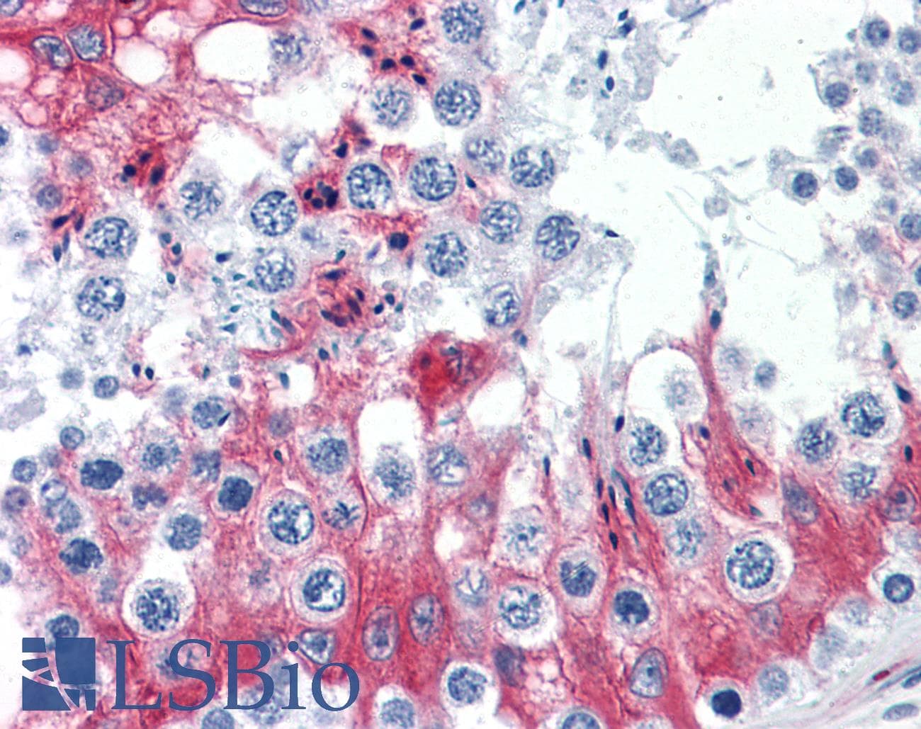 IHC-plus™ SLMAP / SLAP Antibody (clone 2A7)