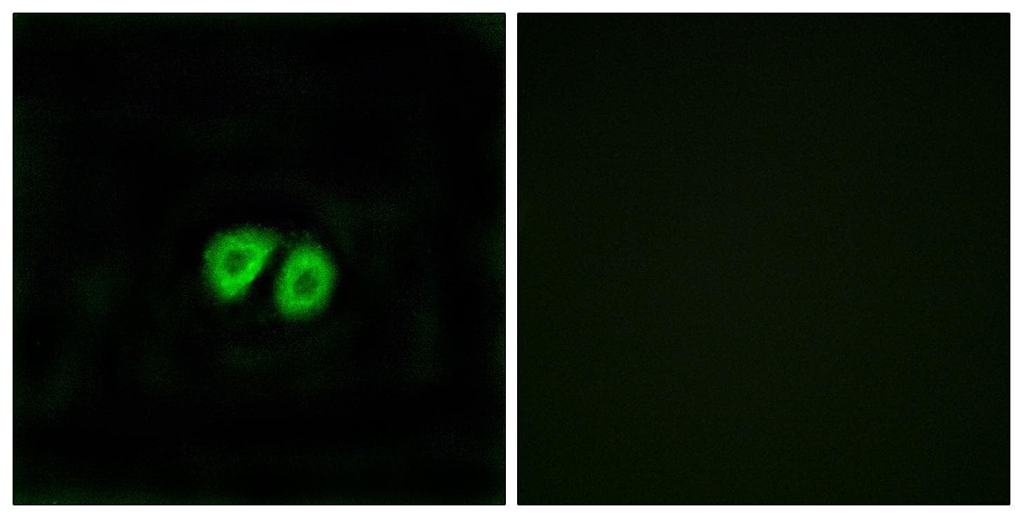ADGRG1 / GPR56 Antibody