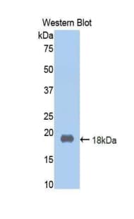 F2 / Prothrombin / Thrombin Antibody (aa201-324)