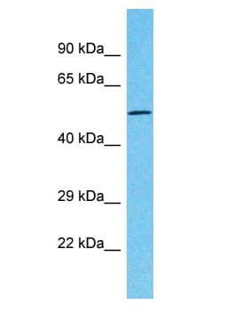 Polyclonal Rabbit anti-Human TTC39C Antibody (aa175-224, WB)