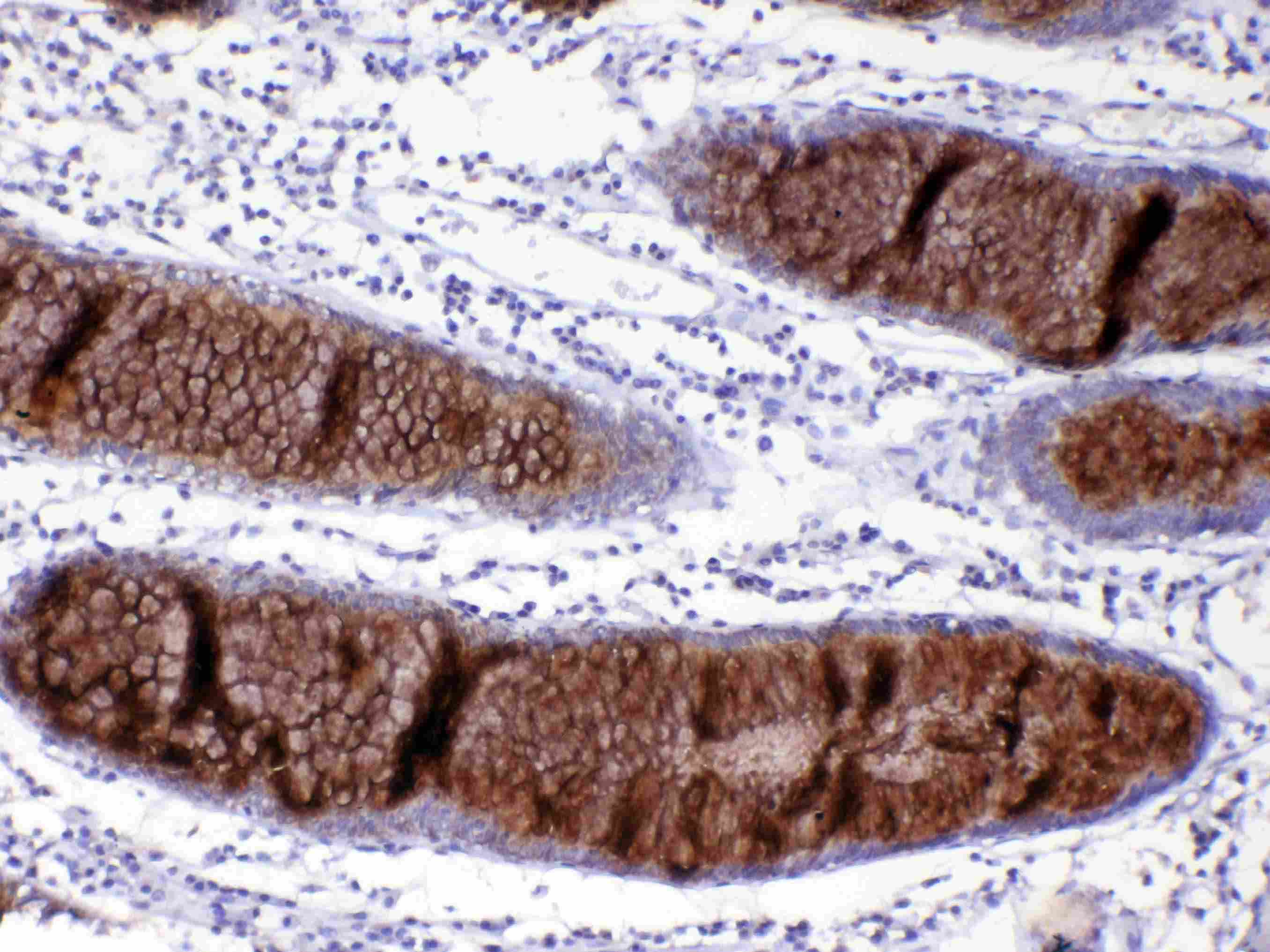 Polyclonal Rabbit anti-Human Mucin 2 / MUC2 Antibody (IHC)