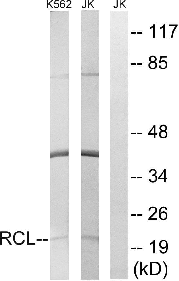 Polyclonal Rabbit anti-Human C6orf108 Antibody (WB)