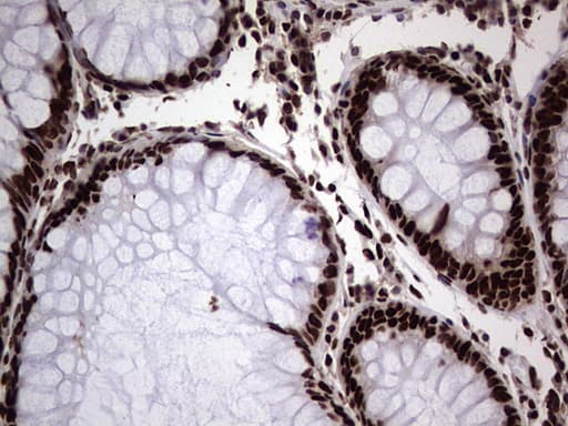 HNRNPL / hnRNP L Antibody (aa270-502, clone OTI2E4)