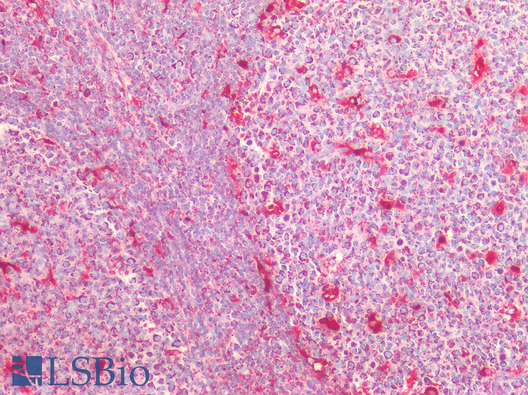 PathPlus™ CTSS / Cathepsin S Antibody