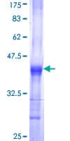 Human UGDH / UDPGDH Protein (Recombinant GST, N-terminus)