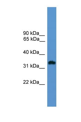 Polyclonal Rabbit anti-Human OR1L8 Antibody (aa201-250, WB)
