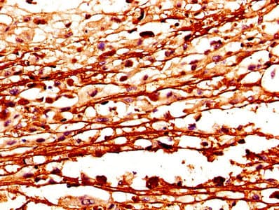 Polyclonal Rabbit anti-Human CSTA / Cystatin A Antibody