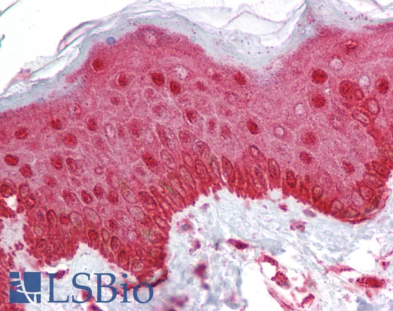 IHC-plus™ ESRP1 / RBM35A Antibody