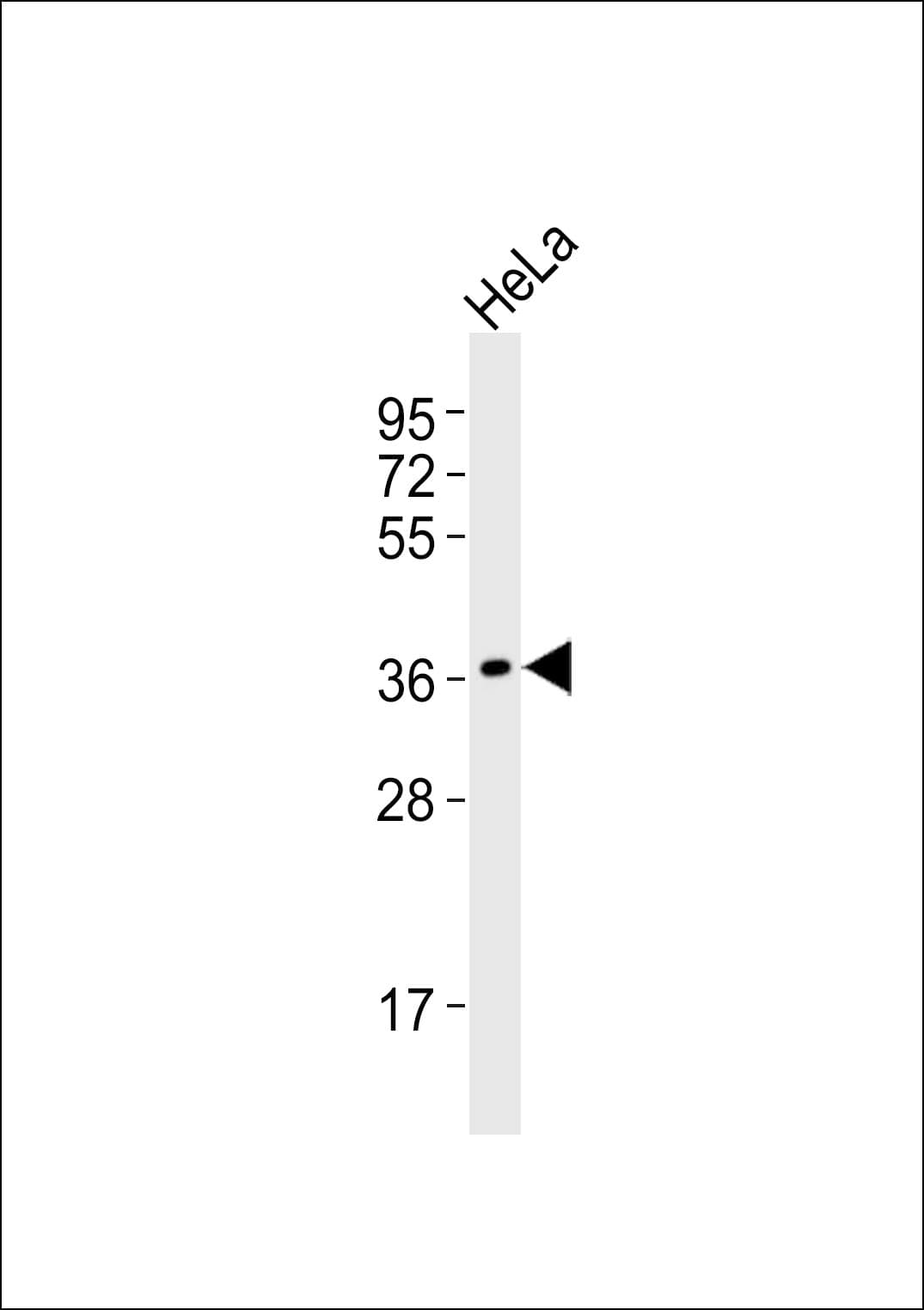 POLR3F Antibody