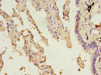 ALDH3A1 Antibody