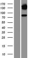 Human NR3C1/Glucocorticoid Receptor Protein (Over-Expression Lysate Myc-DDK (Flag))