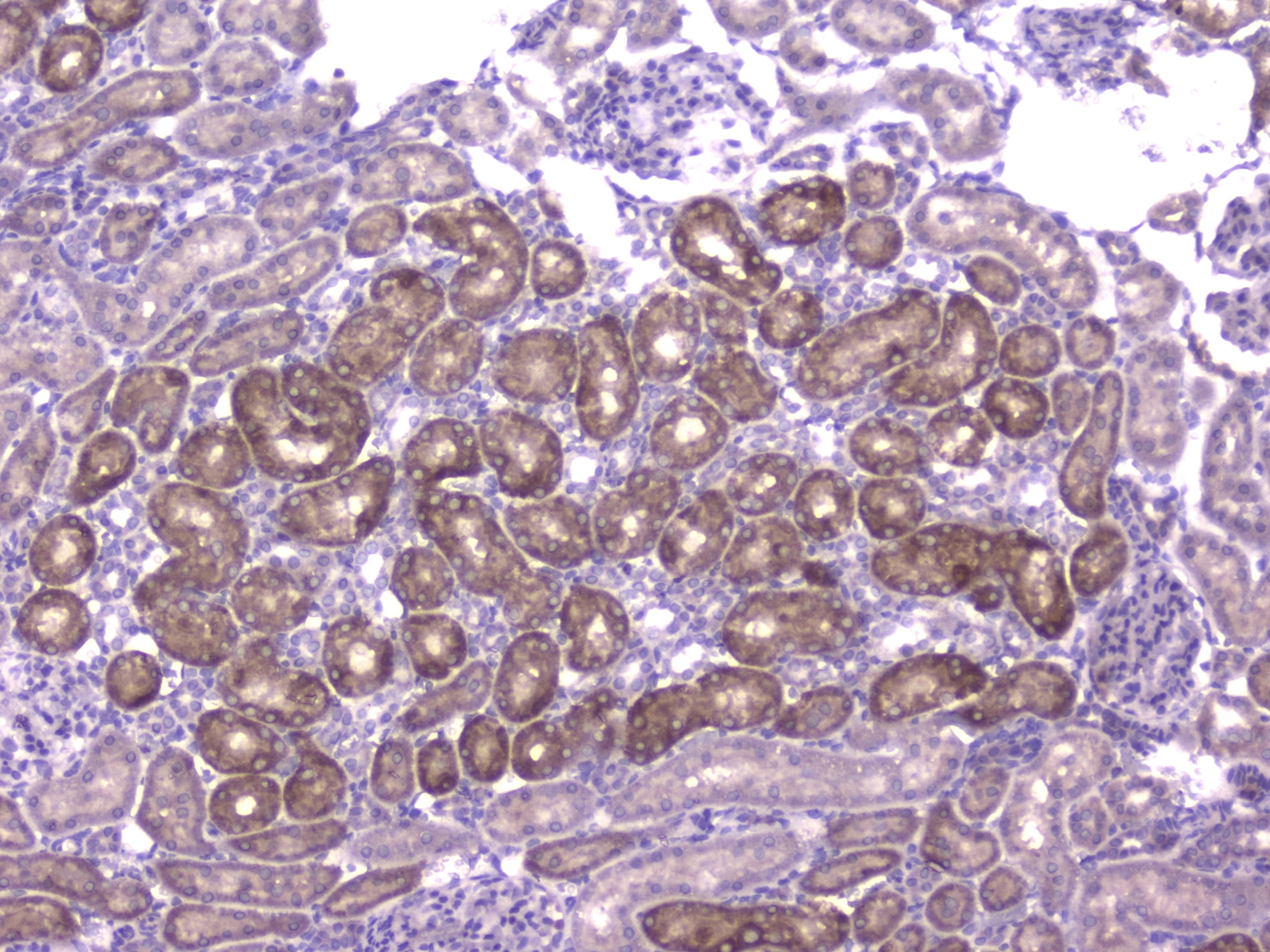 CCL8 / MCP2 Antibody