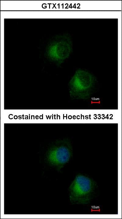 Polyclonal Rabbit anti-Human IFIT3 Antibody (aa230-490, IHC, WB)