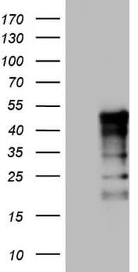 TET3 Antibody (aa241-568, clone OTI5A4)
