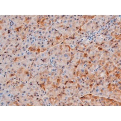 LIMK2 Antibody (phospho-Ser283)