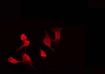 Polyclonal Rabbit anti-Human APOBEC4 Antibody (IF, WB)