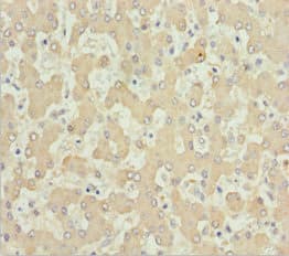 AKR7A2 / AFAR Antibody