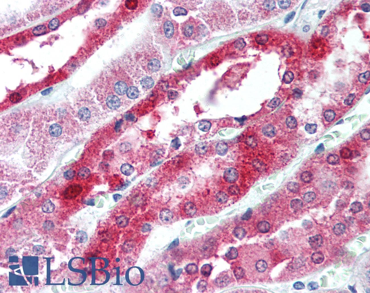 PathPlus™ OCLN / Occludin Antibody (C-Terminus)