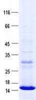 Human ZSWIM7 Protein (Recombinant His, N-Terminal)